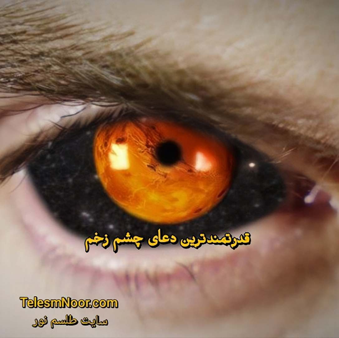 دعای چشم زخم